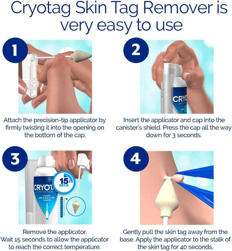 Skin Tag Remover - Fast Effective Safe Skin Tag Removal- Removes Skin Tags in as Little as 1 Treatment, Clinically Proven, up to 12 Treatments